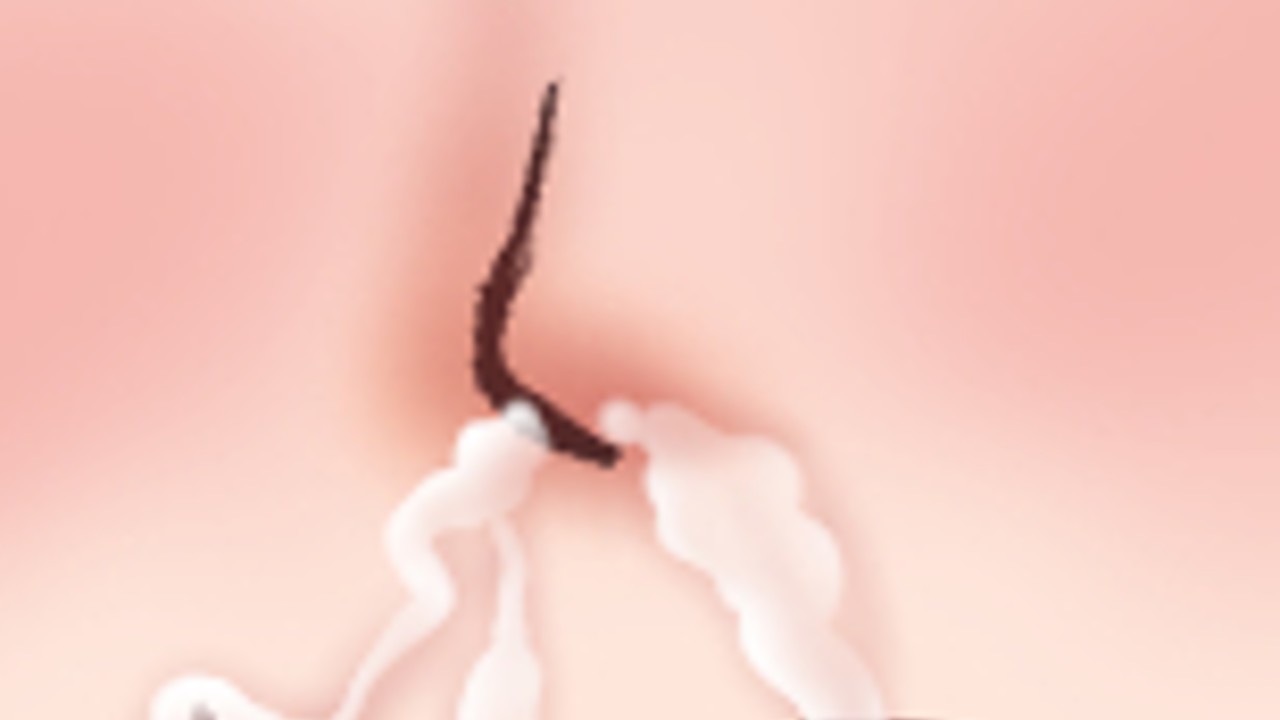 【86日目】鼻から